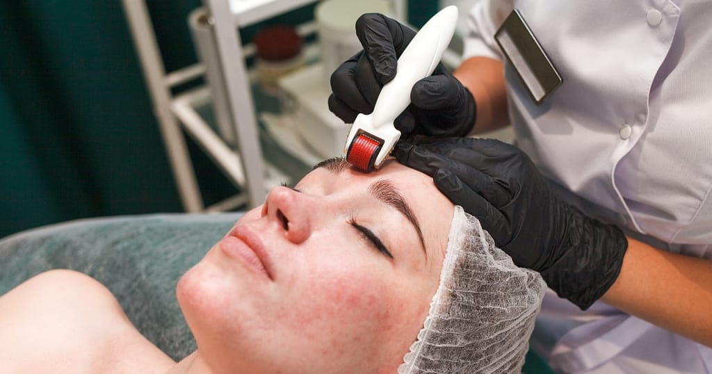 best at-home derma roller