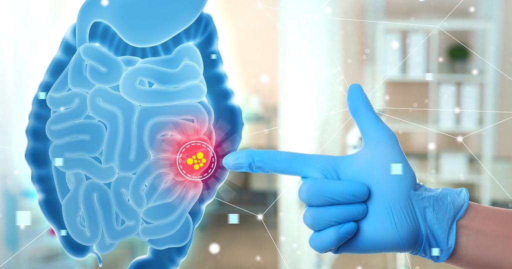 inflammation causes, triggers, and risks