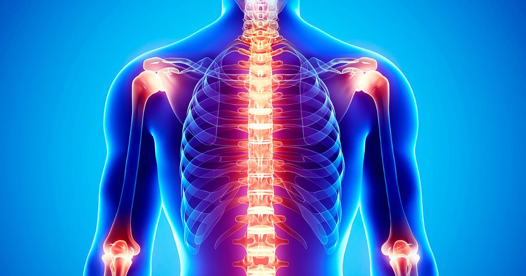 best anti-inflammatory supplements