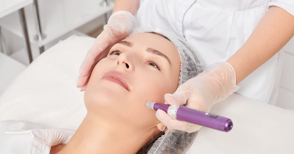face healing after microneedling