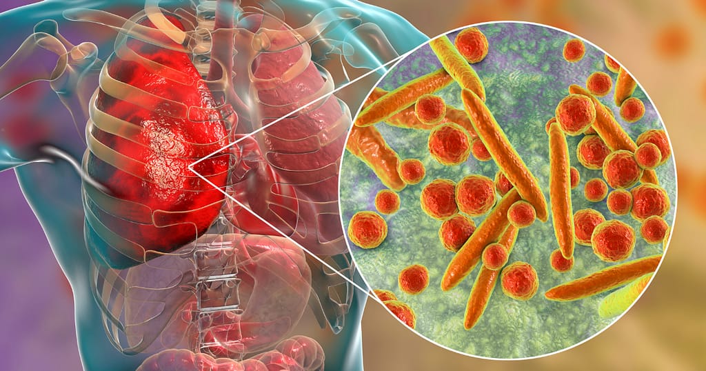 causes of inflammation