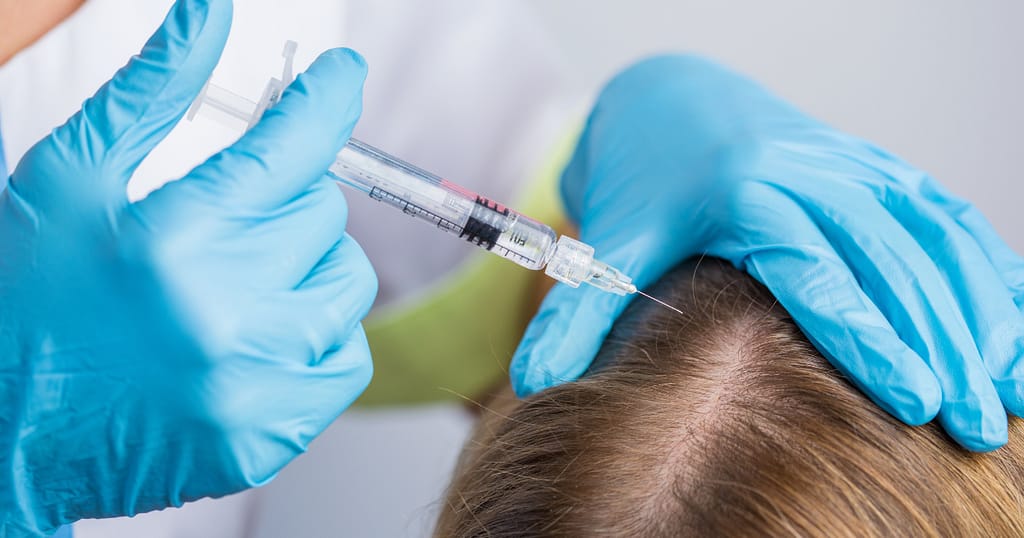 dermatologist recommended products for regrowing hair on bald spots