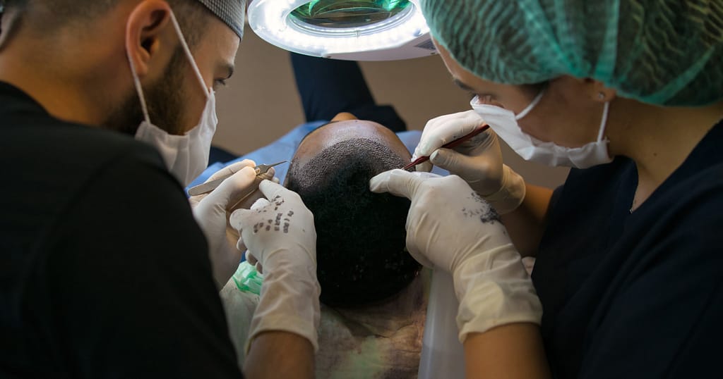 hair growth for women