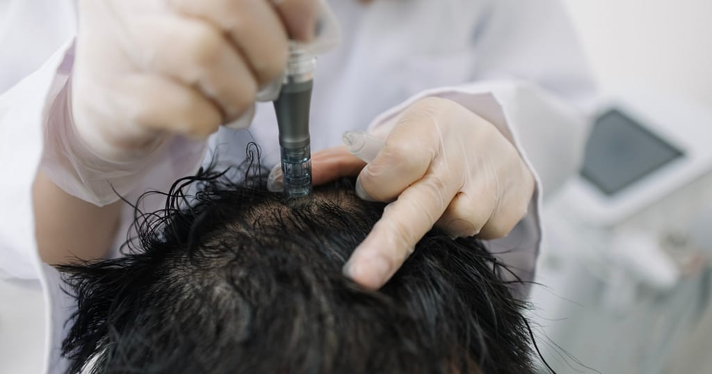 best Jamaican black castor oil for hair growth