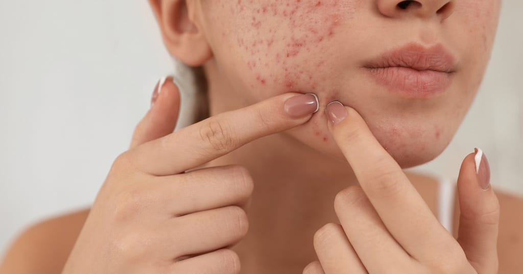 Dark spots removal Sensitive skin care tips Skin redness treatment Uneven skin tone solutions Rosacea solutions Psoriasis management tips Eczema skin care