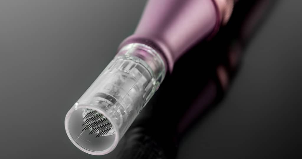 Stretch marks skin treatments Non-invasive stretch mark treatments Improve stretch marks without surgery Advanced stretch mark removal techniques