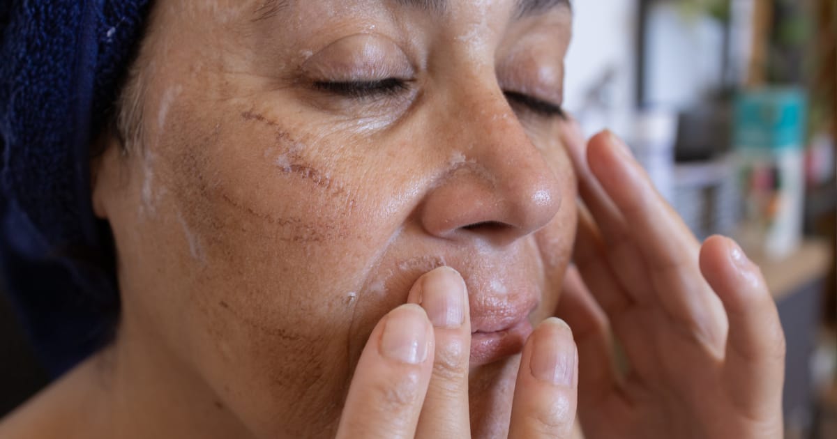 treating hyperpigmented skin