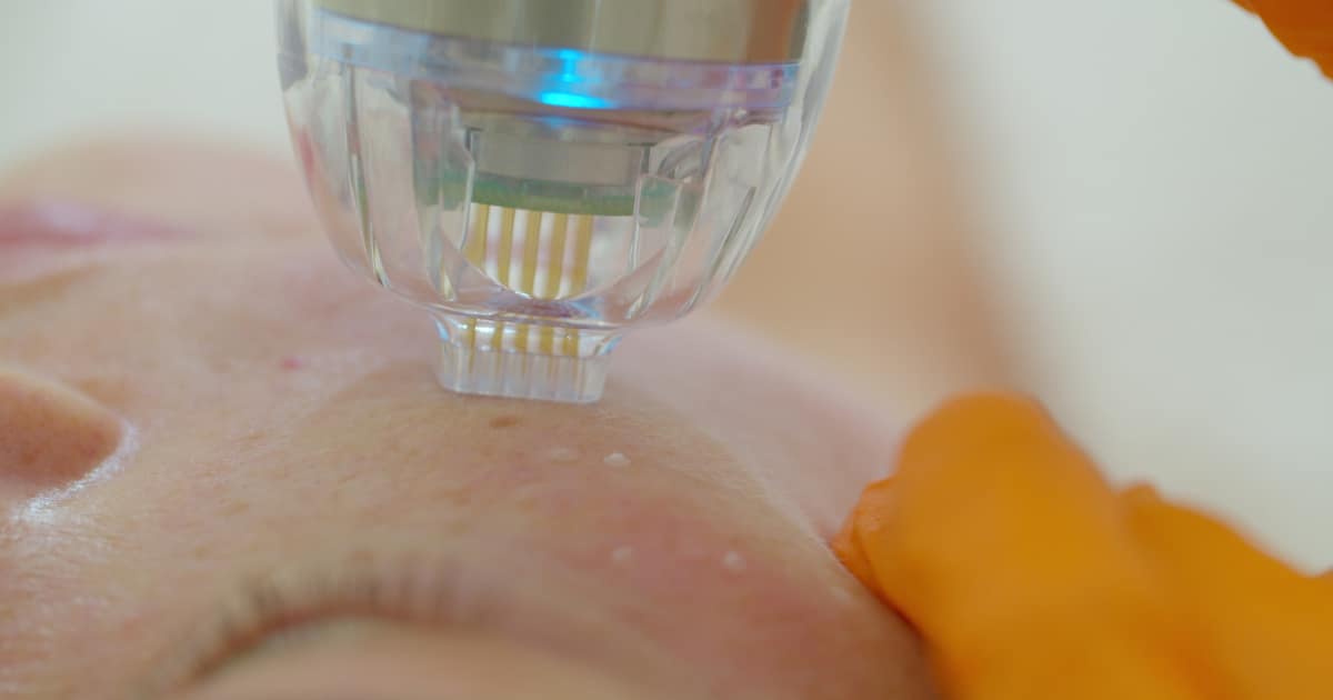 choosing the best microneedle device