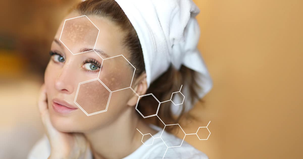 best medical-grade skin care for hyperpigmentation