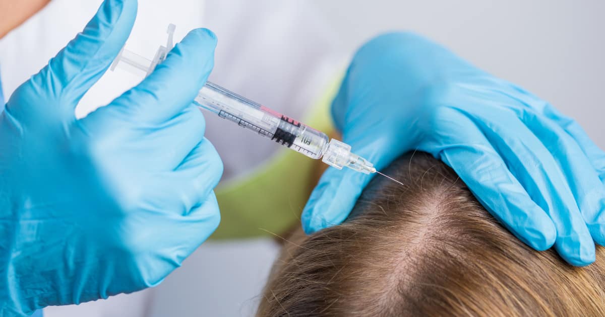 dermatologist recommended products for regrowing hair on bald spots