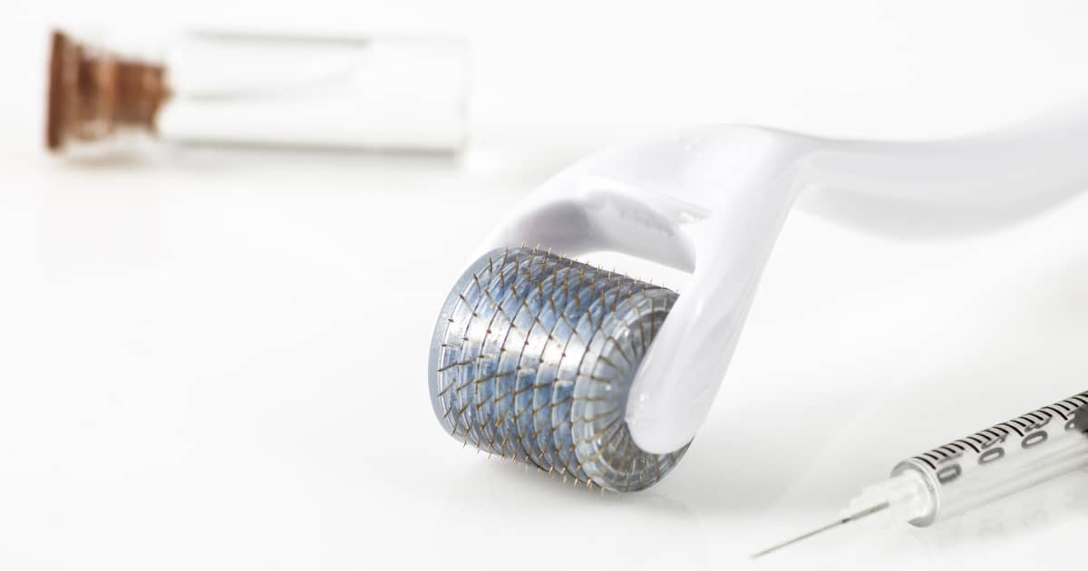 microneedling for stretch marks with natural oils Hyaluronic acid with microneedling Microneedling with serums for better results